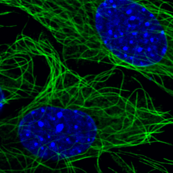 Image acquired on Illinois State University's Leica SP8 Confocal microscope during USRF 2021 with support from Dr. Edwards